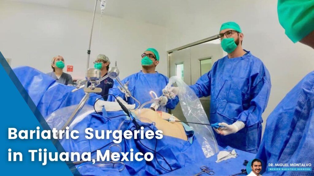 Bariatric Surgeries in Mexico by Dr. Miguel Montalvo
